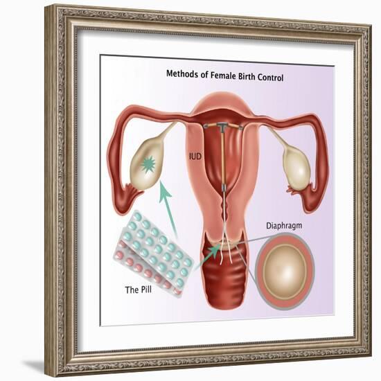 Methods of Female Birth Control-Gwen Shockey-Framed Giclee Print