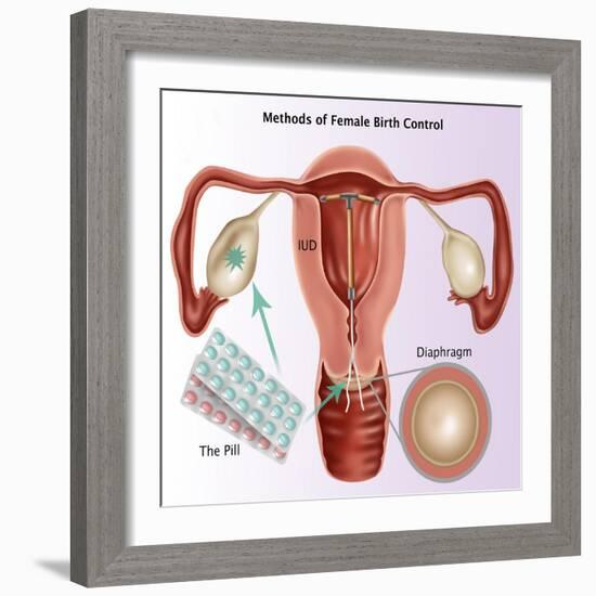 Methods of Female Birth Control-Gwen Shockey-Framed Giclee Print