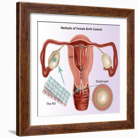 Methods of Female Birth Control-Gwen Shockey-Framed Giclee Print