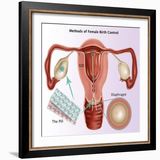 Methods of Female Birth Control-Gwen Shockey-Framed Giclee Print