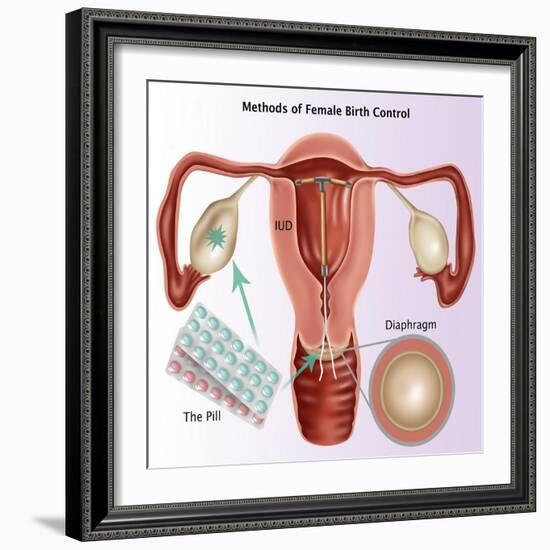 Methods of Female Birth Control-Gwen Shockey-Framed Giclee Print