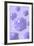 Microscipic View of Pancreatic Cancer Cells-null-Framed Art Print