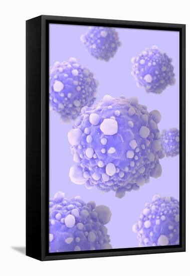 Microscipic View of Pancreatic Cancer Cells-null-Framed Stretched Canvas