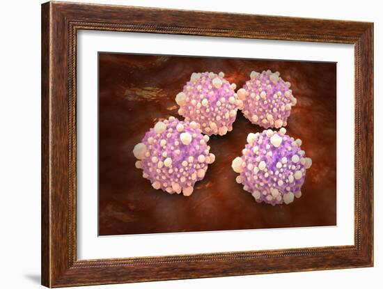 Microscipic View of Pancreatic Cancer Cells-null-Framed Art Print