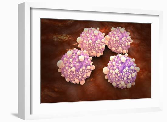 Microscipic View of Pancreatic Cancer Cells-null-Framed Art Print