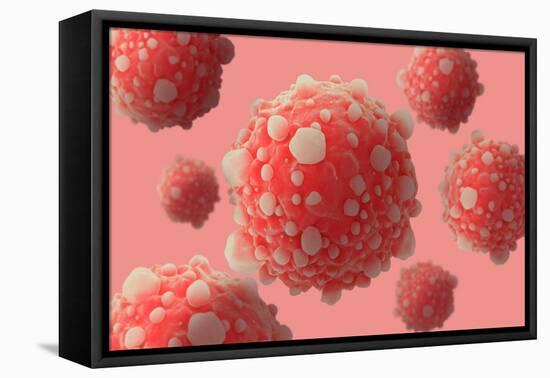 Microscipic View of Pancreatic Cancer Cells-null-Framed Stretched Canvas