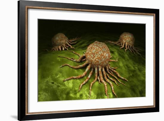 Microscopic View of Cancer Virus-null-Framed Art Print