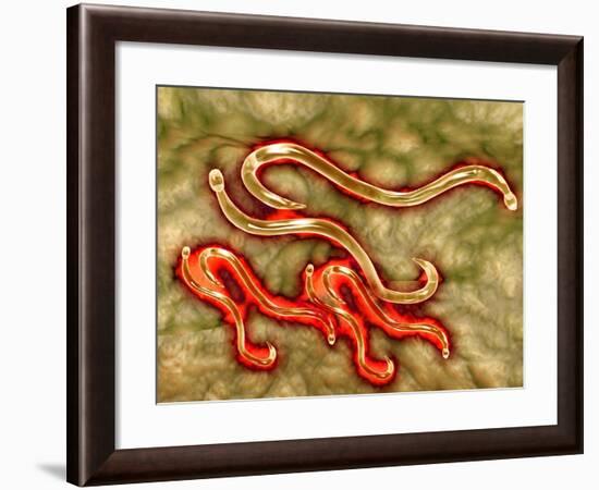 Microscopic View of Hookworm-null-Framed Art Print