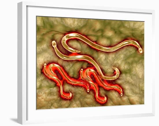 Microscopic View of Hookworm-null-Framed Art Print