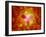 Microscopic View of Human Anitbodies with Red Blood Cells-null-Framed Art Print