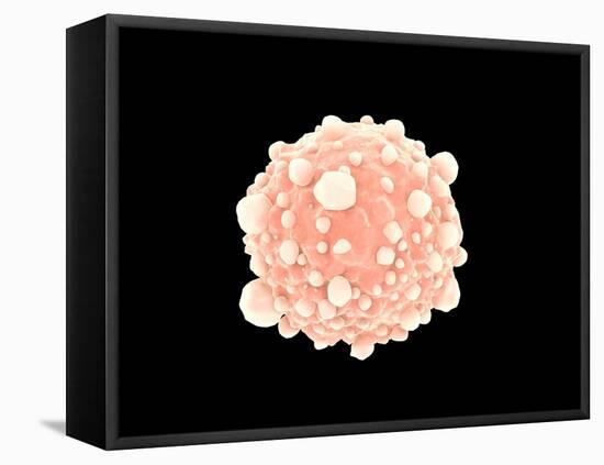 Microscopic View of Pancreatic Cancer Cell-null-Framed Stretched Canvas