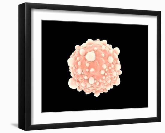 Microscopic View of Pancreatic Cancer Cell-null-Framed Art Print