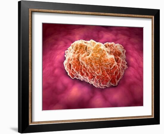 Microscopic View of Tumor-null-Framed Art Print