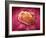 Microscopic View of Tumor-null-Framed Art Print