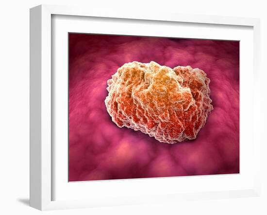 Microscopic View of Tumor-null-Framed Art Print