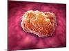 Microscopic View of Tumor-null-Mounted Art Print