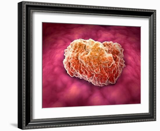Microscopic View of Tumor-null-Framed Art Print