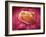 Microscopic View of Tumor-null-Framed Art Print