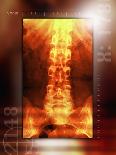 Normal Spine, X-ray-Miriam Maslo-Photographic Print
