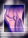 Woman's Legs, with Knee X-ray-Miriam Maslo-Photographic Print