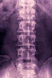 Normal Lumbar Spine, X-ray-Miriam Maslo-Photographic Print