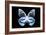 Miss Butterfly Prioneris - X-Ray Black Edition-Philippe Hugonnard-Framed Photographic Print