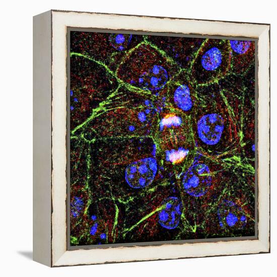 Mitosis, Fluorescence Micrograph-Science Photo Library-Framed Premier Image Canvas