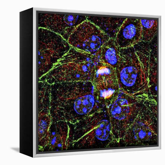 Mitosis, Fluorescence Micrograph-Science Photo Library-Framed Premier Image Canvas