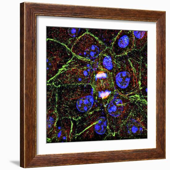 Mitosis, Fluorescence Micrograph-Science Photo Library-Framed Premium Photographic Print