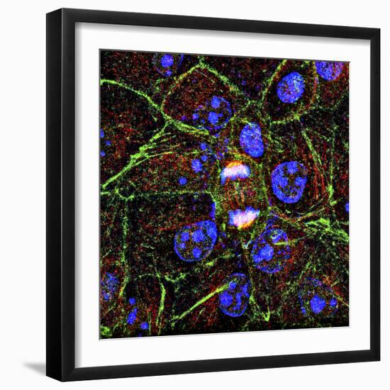 Mitosis, Fluorescence Micrograph-Science Photo Library-Framed Premium Photographic Print