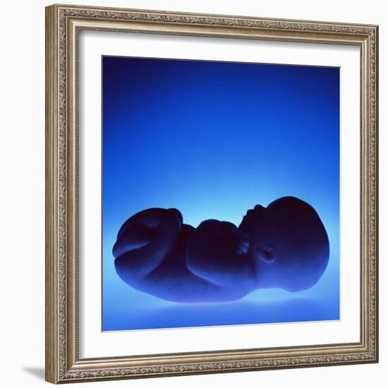 Model of a Foetus-Kevin Curtis-Framed Premium Photographic Print