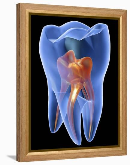 Molar Tooth-PASIEKA-Framed Premier Image Canvas