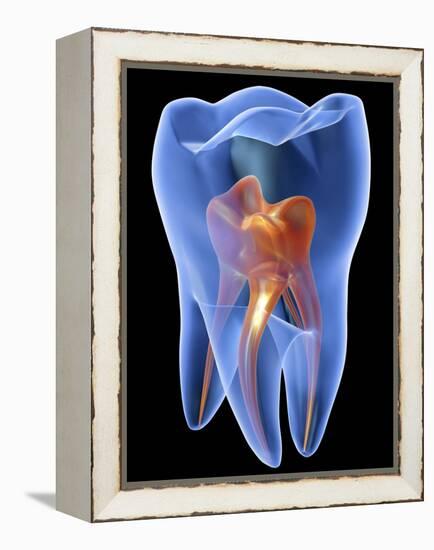 Molar Tooth-PASIEKA-Framed Premier Image Canvas