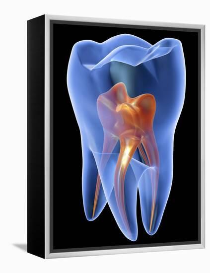 Molar Tooth-PASIEKA-Framed Premier Image Canvas