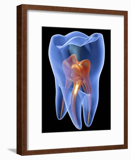 Molar Tooth-PASIEKA-Framed Photographic Print