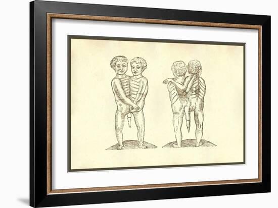 Monstrum Biceps Caudatum Prone & Supine-Ulisse Aldrovandi-Framed Art Print