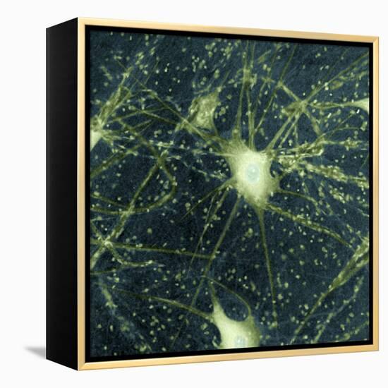 Motor Neurons, Light Micrograph-Steve Gschmeissner-Framed Premier Image Canvas