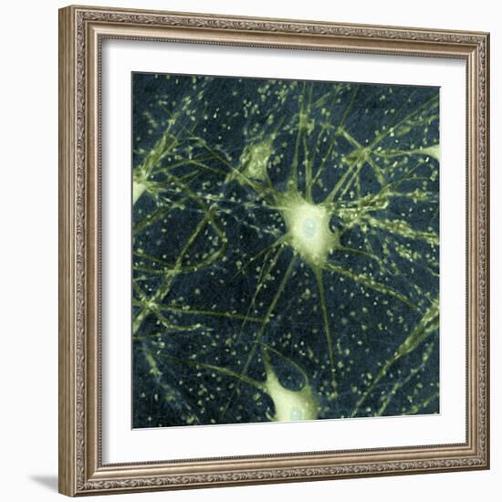 Motor Neurons, Light Micrograph-Steve Gschmeissner-Framed Premium Photographic Print