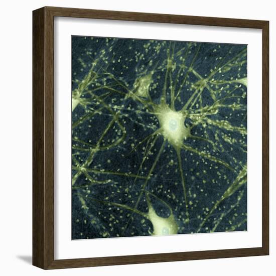 Motor Neurons, Light Micrograph-Steve Gschmeissner-Framed Premium Photographic Print