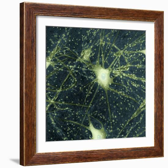 Motor Neurons, Light Micrograph-Steve Gschmeissner-Framed Premium Photographic Print