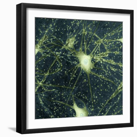 Motor Neurons, Light Micrograph-Steve Gschmeissner-Framed Premium Photographic Print