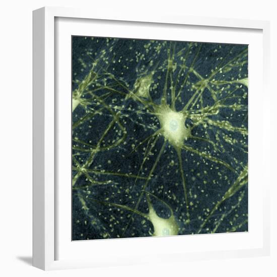 Motor Neurons, Light Micrograph-Steve Gschmeissner-Framed Premium Photographic Print