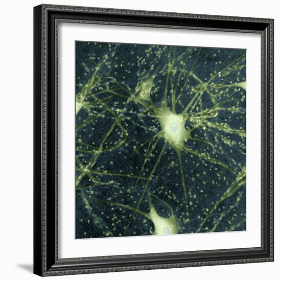 Motor Neurons, Light Micrograph-Steve Gschmeissner-Framed Premium Photographic Print