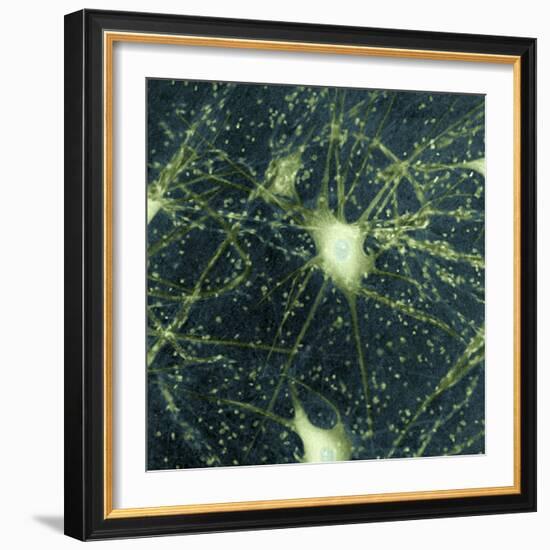 Motor Neurons, Light Micrograph-Steve Gschmeissner-Framed Premium Photographic Print