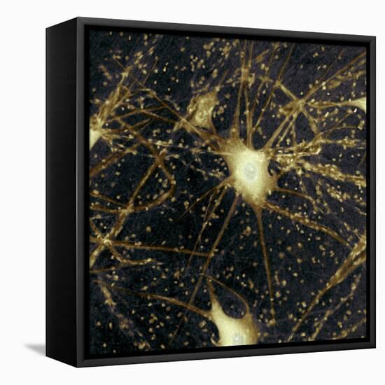 Motor Neurons, Light Micrograph-Steve Gschmeissner-Framed Premier Image Canvas