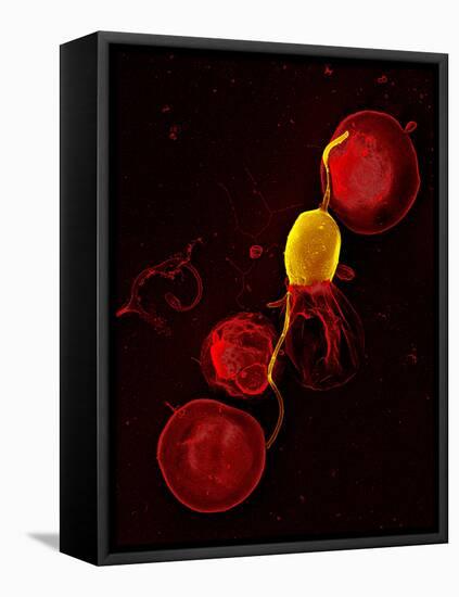 Mouse Malaria Parasite, SEM-Science Photo Library-Framed Premier Image Canvas