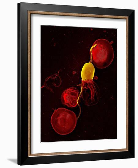 Mouse Malaria Parasite, SEM-Science Photo Library-Framed Photographic Print