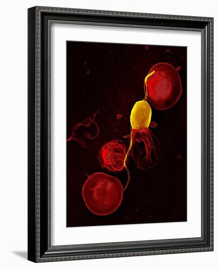 Mouse Malaria Parasite, SEM-Science Photo Library-Framed Photographic Print