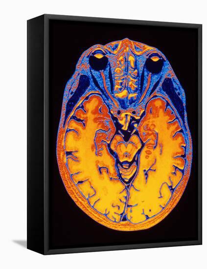 MRI Brain Scan-PASIEKA-Framed Premier Image Canvas