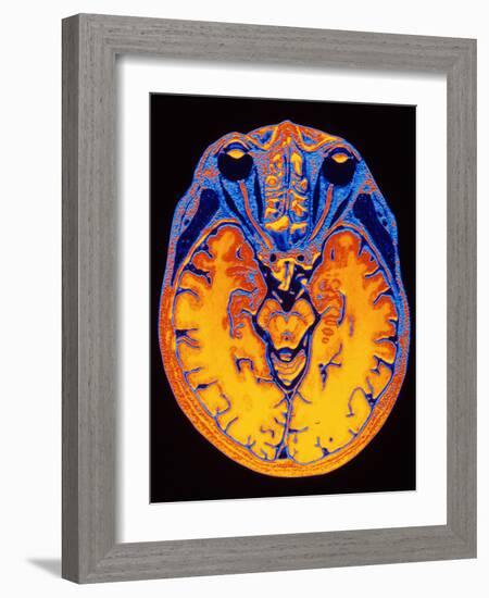 MRI Brain Scan-PASIEKA-Framed Photographic Print